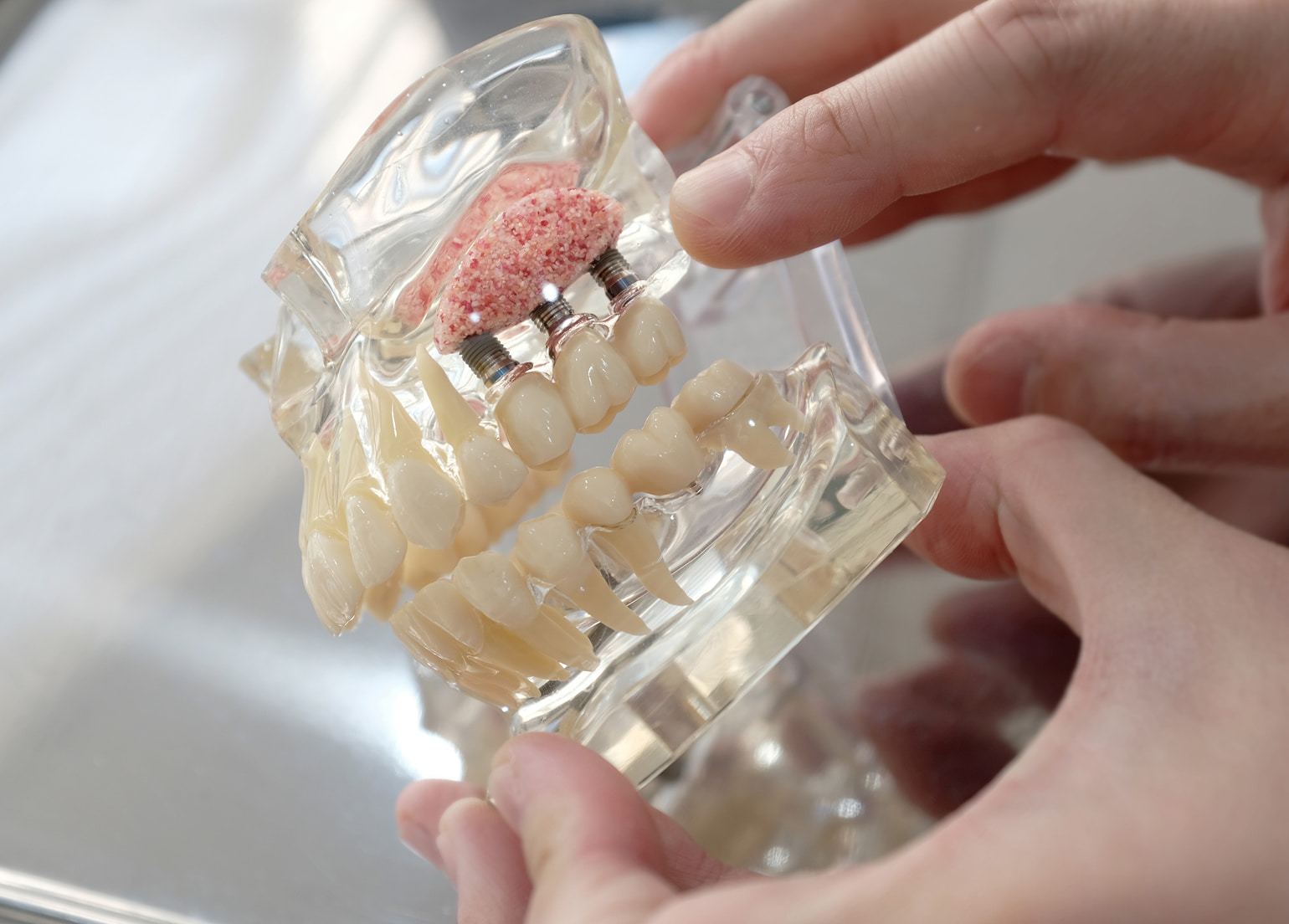 Modern dentistry solutions for bone loss to support natural-looking dental implants in Jasper