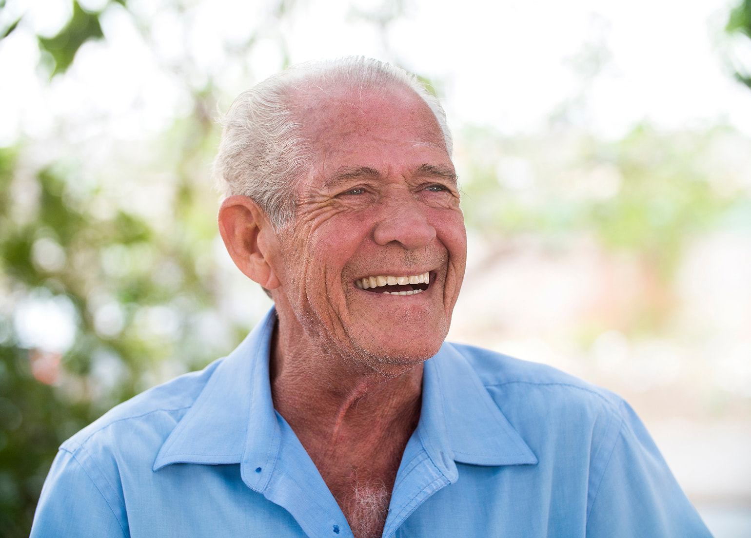 Benefits of implants over dentures for bone health and stability