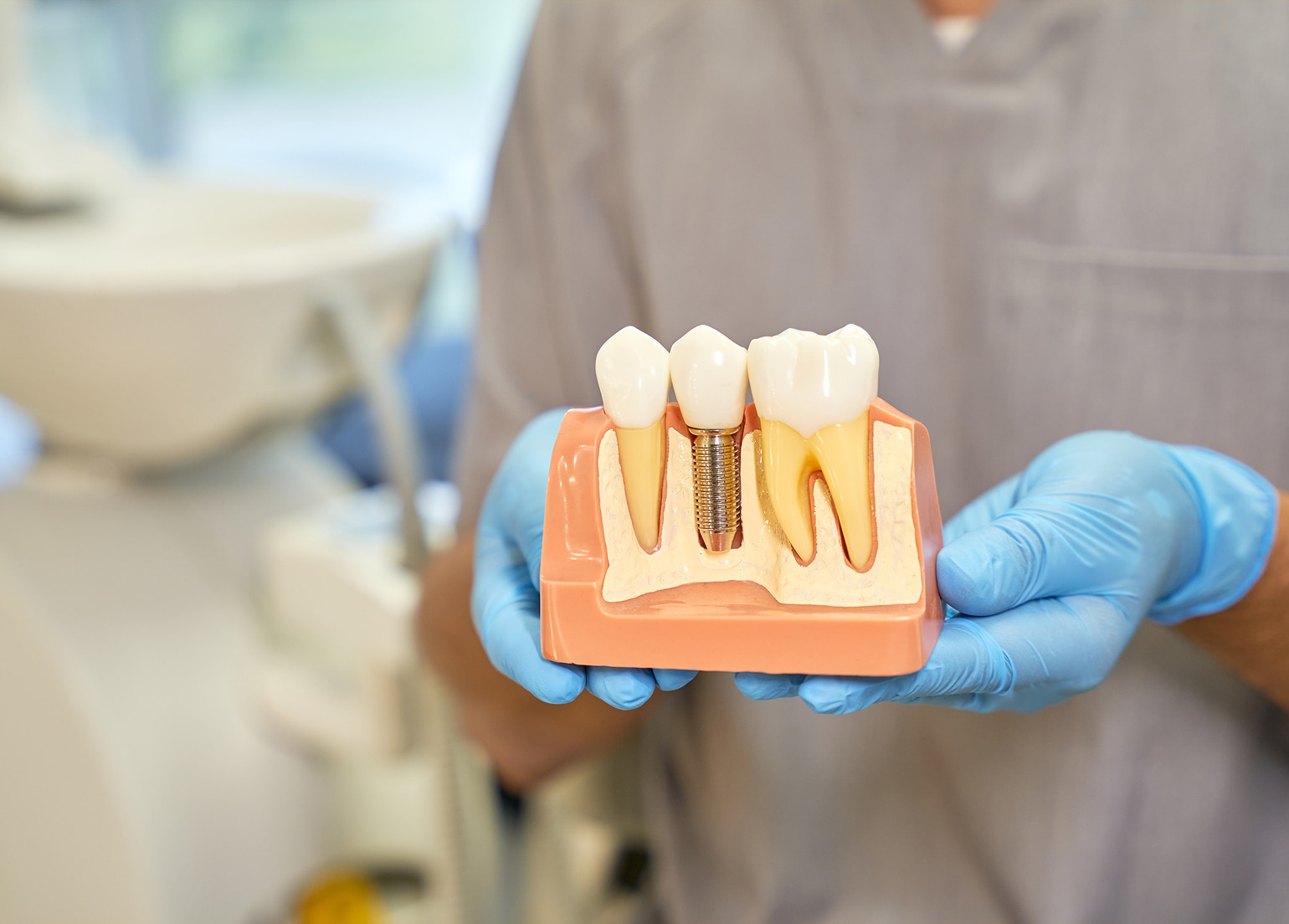 Restore missing teeth with dental implants in Jasper