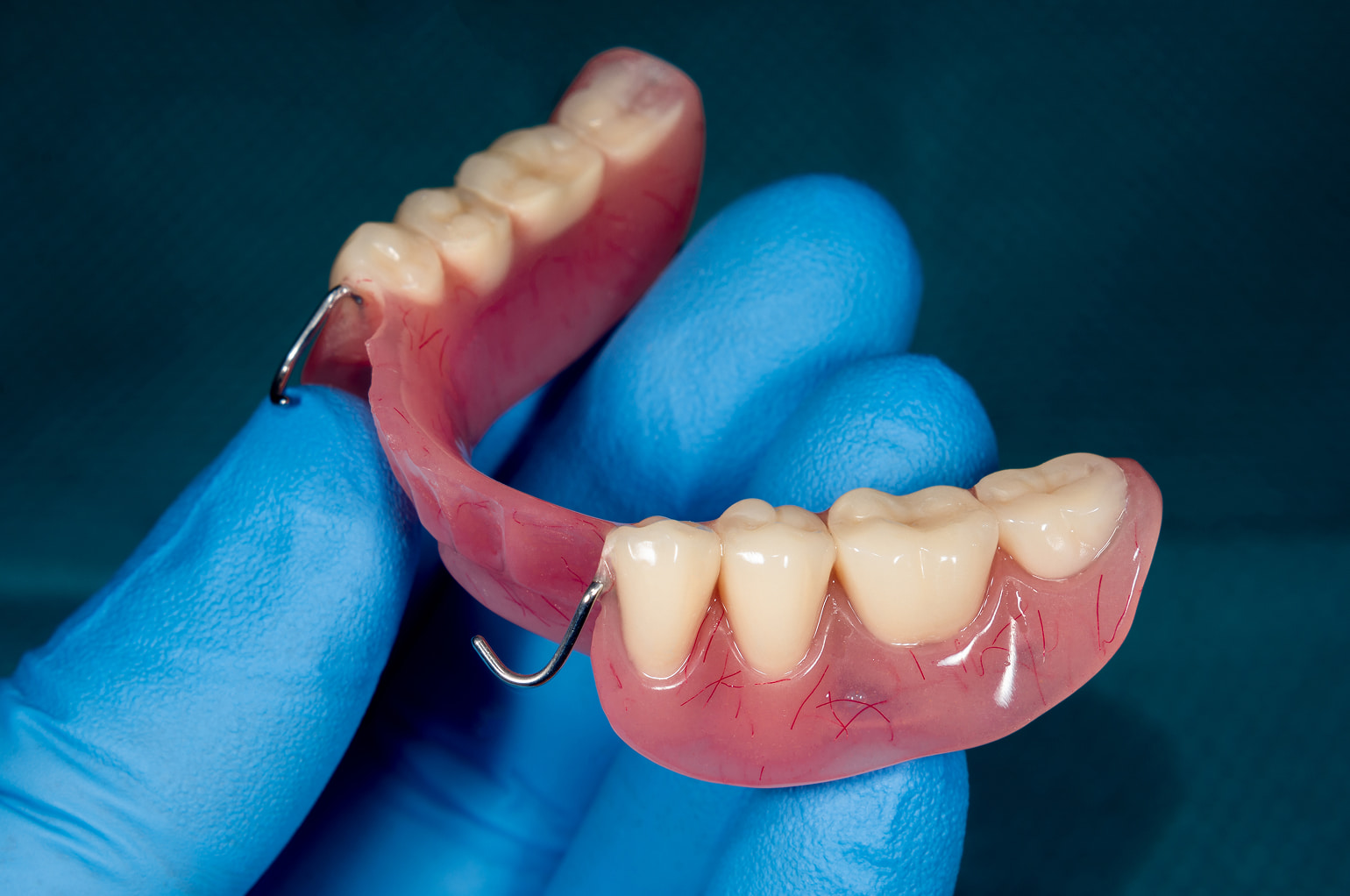 Custom dentures and partials for natural-looking results