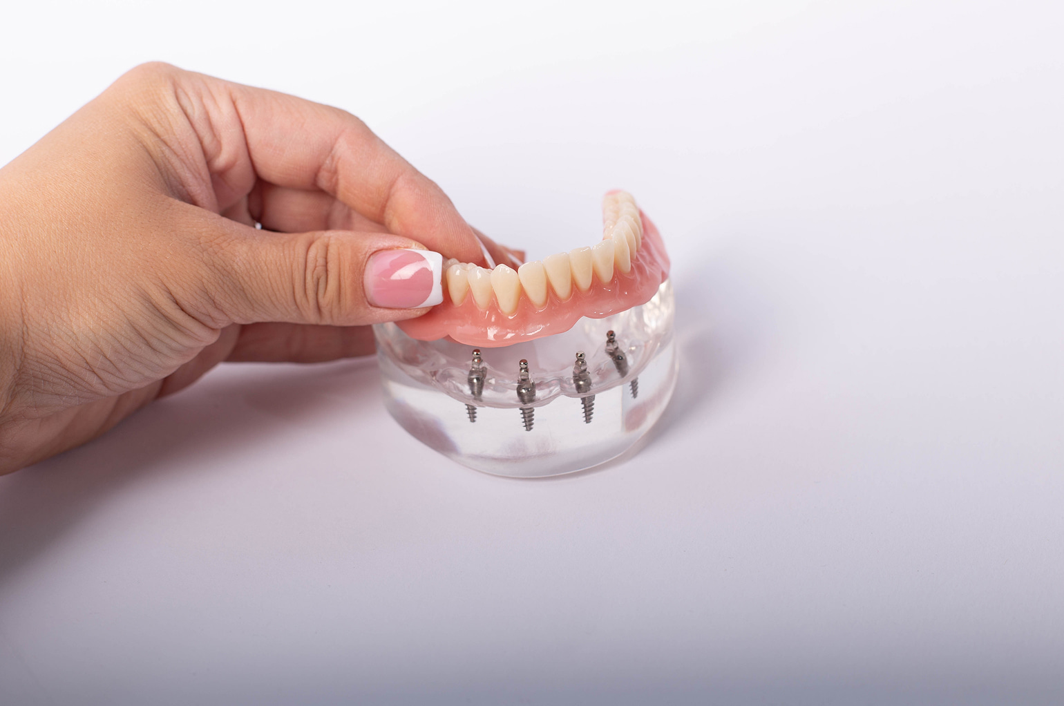Implant-supported dentures prevent bone loss and restore function